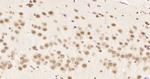 hnRNP K Antibody in Immunohistochemistry (Paraffin) (IHC (P))