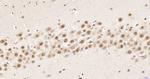 hnRNP K Antibody in Immunohistochemistry (Paraffin) (IHC (P))
