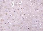 Phospho-IRE1a (Ser726) Antibody in Immunohistochemistry (Paraffin) (IHC (P))