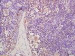 NR0B2 Antibody in Immunohistochemistry (Paraffin) (IHC (P))