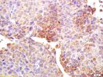 testis antigen 1 Antibody in Immunohistochemistry (Paraffin) (IHC (P))