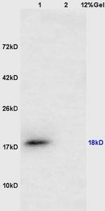 CTAG1 Antibody in Western Blot (WB)