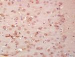 tubulin Beta Antibody in Immunohistochemistry (Paraffin) (IHC (P))