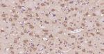 tubulin Beta Antibody in Immunohistochemistry (Paraffin) (IHC (P))