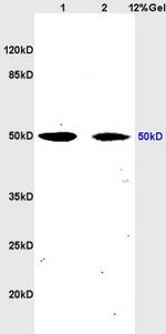 tubulin Beta Antibody in Western Blot (WB)