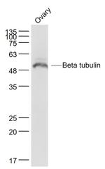 tubulin Beta Antibody in Western Blot (WB)