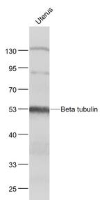 tubulin Beta Antibody in Western Blot (WB)