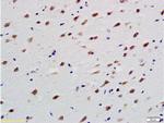beta 3 Tubulin Antibody in Immunohistochemistry (Paraffin) (IHC (P))