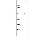 beta 3 Tubulin Antibody in Western Blot (WB)
