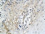 IL-6 Antibody in Immunohistochemistry (Paraffin) (IHC (P))