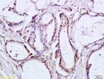 BRLF1 Antibody in Immunohistochemistry (Paraffin) (IHC (P))