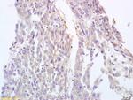 BRLF1 Antibody in Immunohistochemistry (Paraffin) (IHC (P))