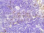 Bcl-2 Antibody in Immunohistochemistry (Paraffin) (IHC (P))