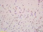VEGF-A Antibody in Immunohistochemistry (Paraffin) (IHC (P))