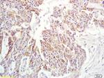 IL-6 Antibody in Immunohistochemistry (Paraffin) (IHC (P))