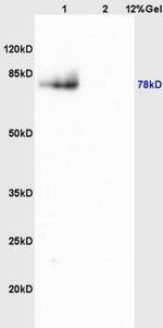 MMP9 Antibody in Western Blot (WB)