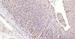 MMP-1 Antibody in Immunohistochemistry (Paraffin) (IHC (P))