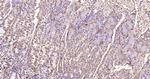 MMP-1 Antibody in Immunohistochemistry (Paraffin) (IHC (P))