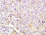 CD105 Antibody in Immunohistochemistry (Paraffin) (IHC (P))