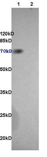 CD105 Antibody in Western Blot (WB)