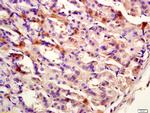 CK12 Antibody in Immunohistochemistry (Paraffin) (IHC (P))