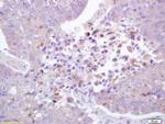 Phospho-ROCK1 (Thr455, Ser456) Antibody in Immunohistochemistry (Paraffin) (IHC (P))