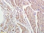 Phospho-ROCK1 (Thr455, Ser456) Antibody in Immunohistochemistry (Paraffin) (IHC (P))