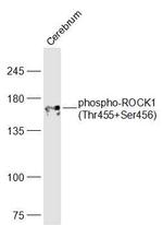 Phospho-ROCK1 (Thr455, Ser456) Antibody in Western Blot (WB)
