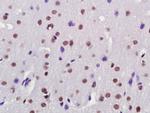 Alpha B Crystallin Antibody in Immunohistochemistry (Paraffin) (IHC (P))