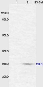 CD161c/NK1.1 Antibody in Western Blot (WB)