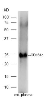CD161c/NK1.1 Antibody in Western Blot (WB)