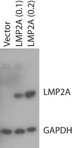 EBV LMP2 Antibody in Western Blot (WB)
