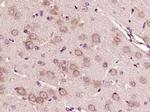 VWF Antibody in Immunohistochemistry (Paraffin) (IHC (P))