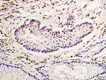 Nucleophosmin Antibody in Immunohistochemistry (Paraffin) (IHC (P))