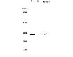 Nucleophosmin Antibody in Western Blot (WB)