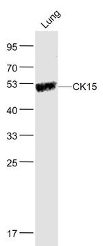 CK15 Antibody in Western Blot (WB)