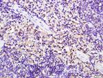 CD8 alpha Antibody in Immunohistochemistry (Paraffin) (IHC (P))