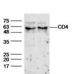 CD4 Antibody in Western Blot (WB)
