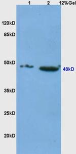 CD4 Antibody in Western Blot (WB)