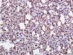 Phospho-eIF2 alpha subunit 1 (Ser52) Antibody in Immunohistochemistry (Paraffin) (IHC (P))