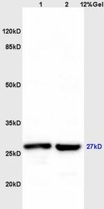 MS4A2 Antibody in Western Blot (WB)