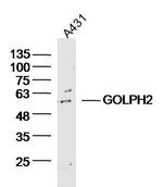 GOLPH2 Antibody in Western Blot (WB)