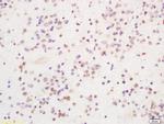 PIRH2 Antibody in Immunohistochemistry (Paraffin) (IHC (P))