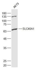 SLC40A1 Antibody in Western Blot (WB)