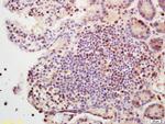 SETBP1 Antibody in Immunohistochemistry (Paraffin) (IHC (P))