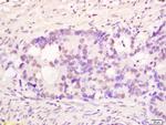 PMS1 Antibody in Immunohistochemistry (Paraffin) (IHC (P))
