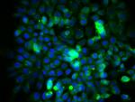 eIF4E Antibody in Immunocytochemistry (ICC/IF)