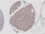 eIF4E Antibody in Immunohistochemistry (Paraffin) (IHC (P))