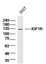 IGF1R Antibody in Western Blot (WB)