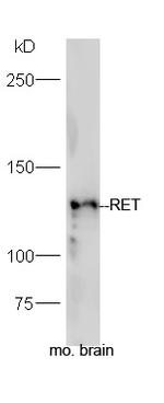 RET Antibody in Western Blot (WB)